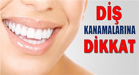 Dişeti kanaması tedavisi