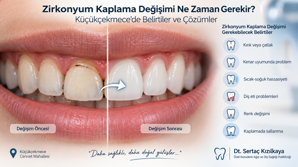 küçükçekmece zirkonyum kaplama değişimi